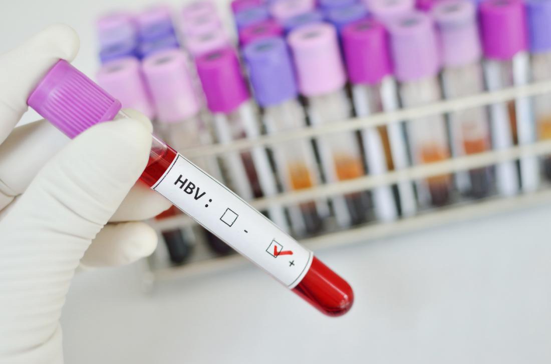 HBsAg анализ крови